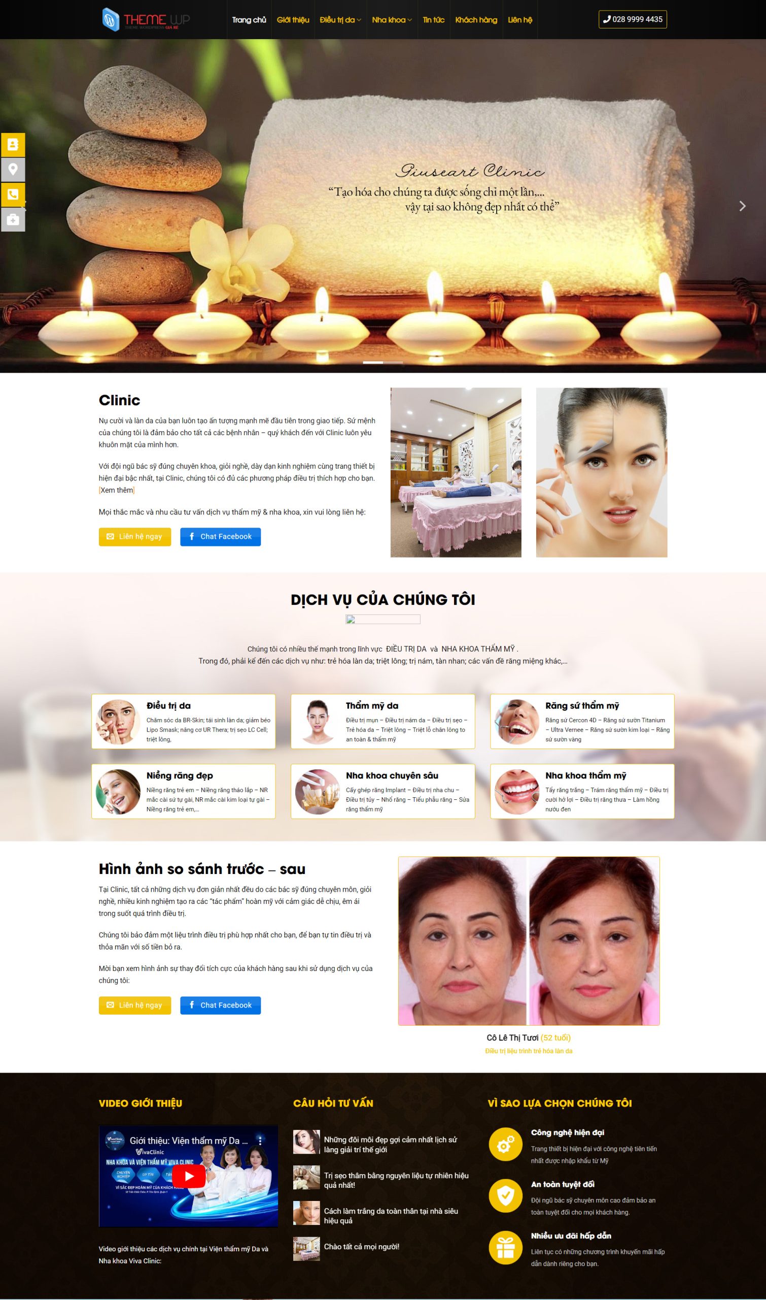 V1744 – Thiết Kế Website Spa 01