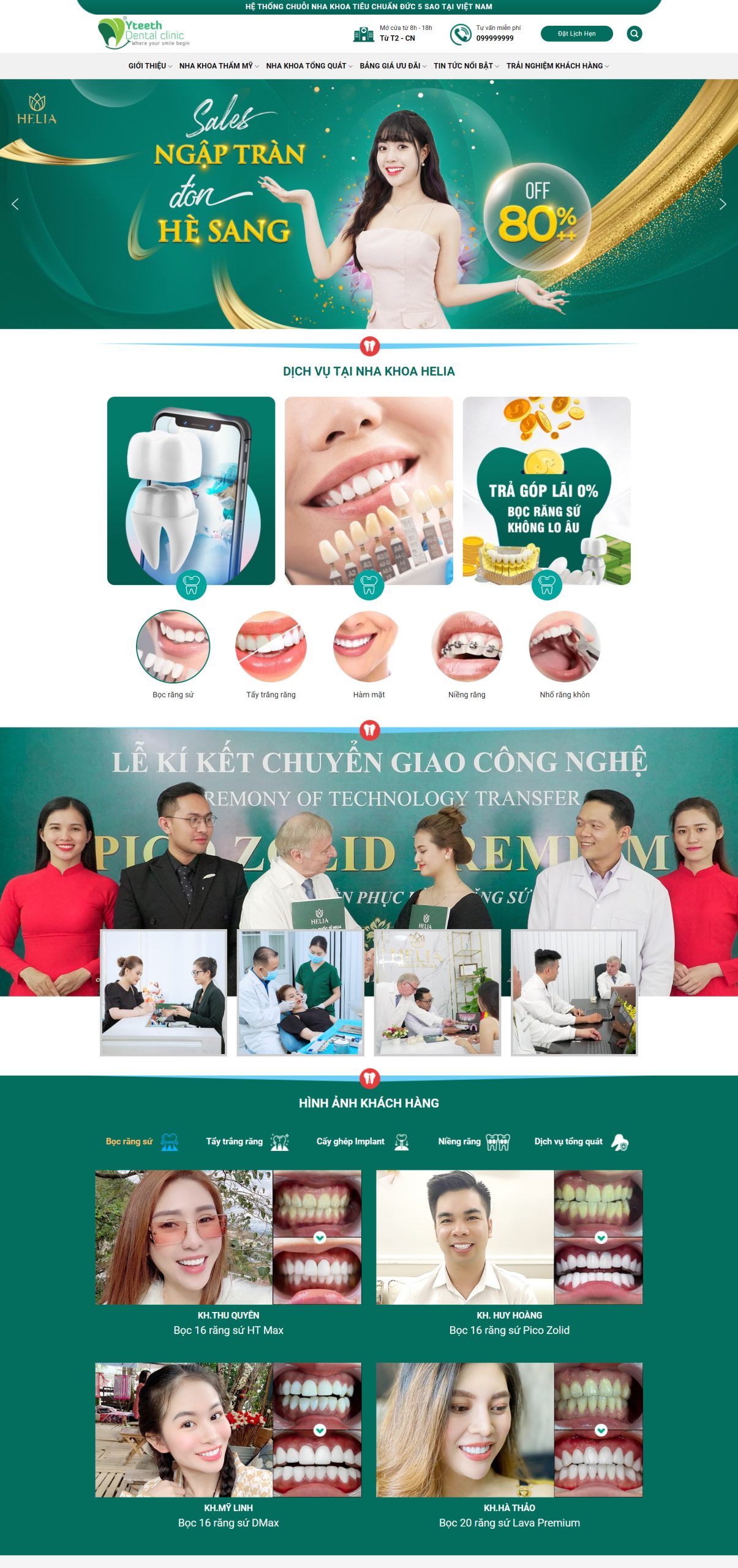 V1598 – Thiết Kế Website Nha Khoa 1
